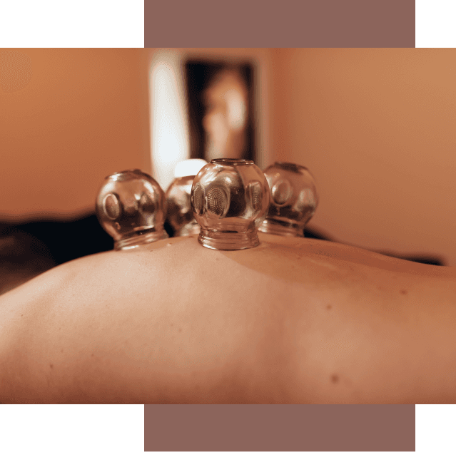 Traitement par ventouses